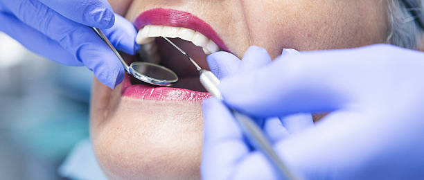 Best Emergency Dental Care for Sports Injuries in Folly Beach, SC